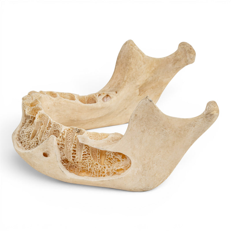 Real Human Mandible - Dissected