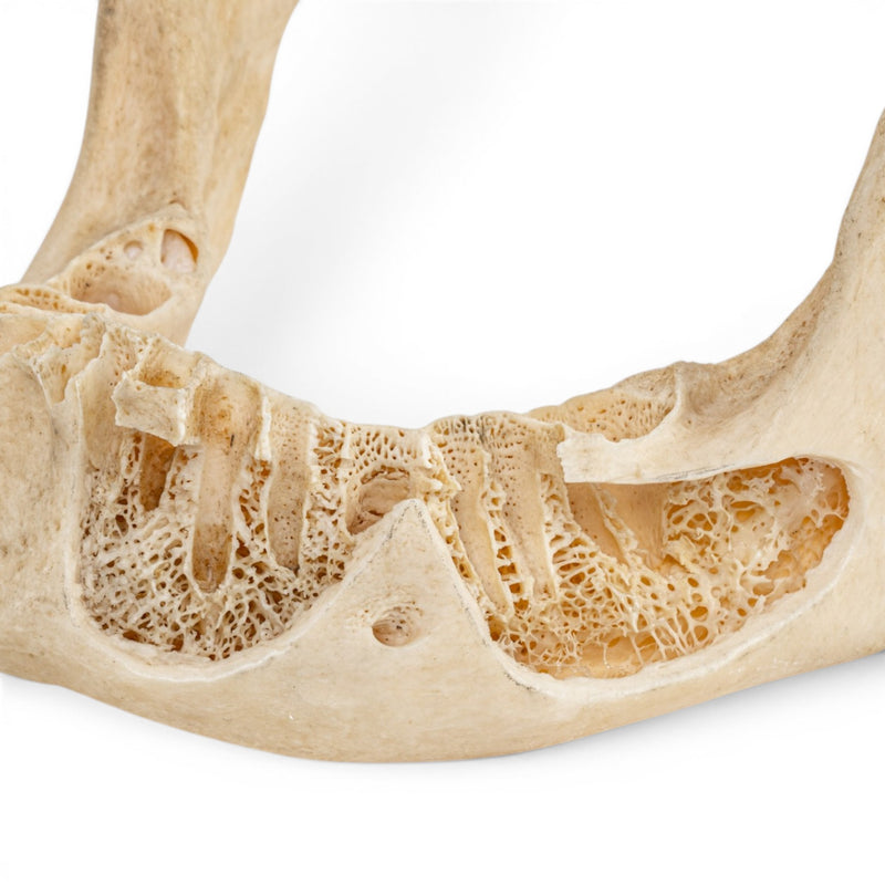 Real Human Mandible - Dissected