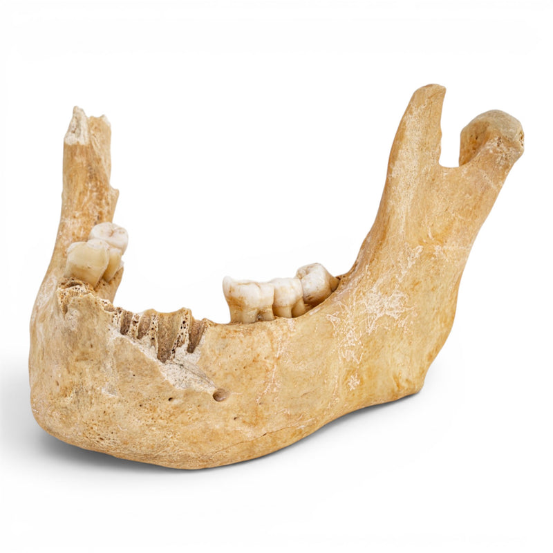 Real Human Mandible - Antique