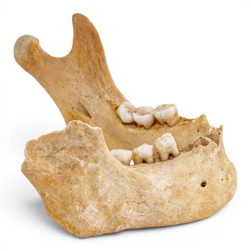 Real Human Mandible - Antique