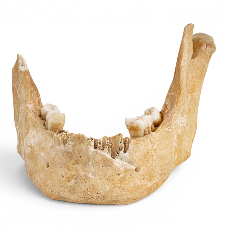 Real Human Mandible - Antique