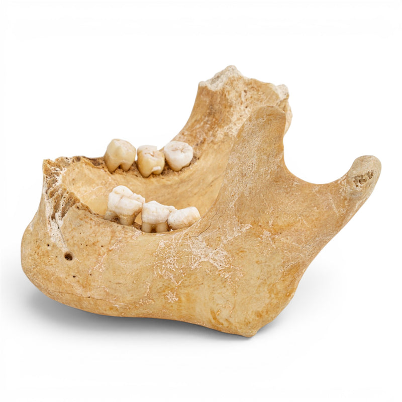 Real Human Mandible - Antique