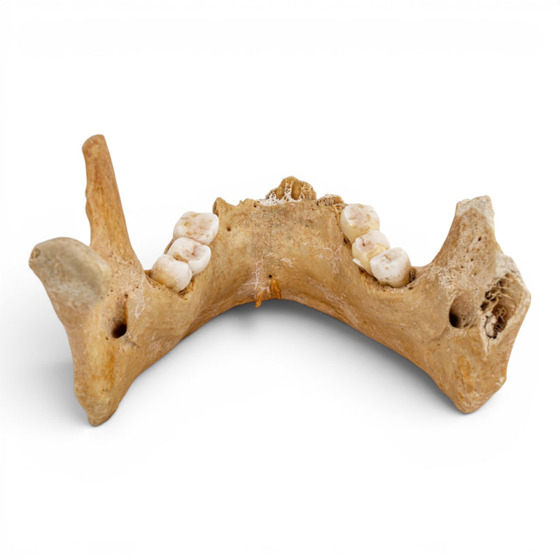 Real Human Mandible - Antique