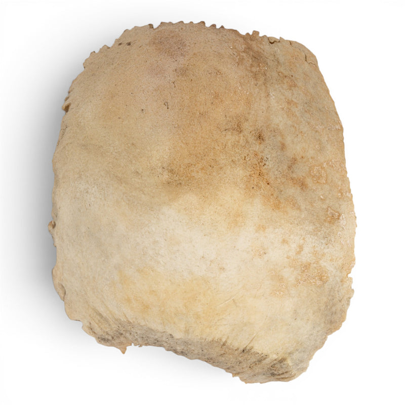 Real Human Parietal Bone