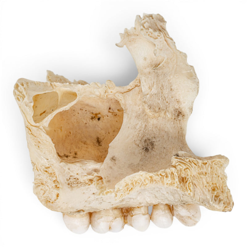 Real Human Maxillary Bone
