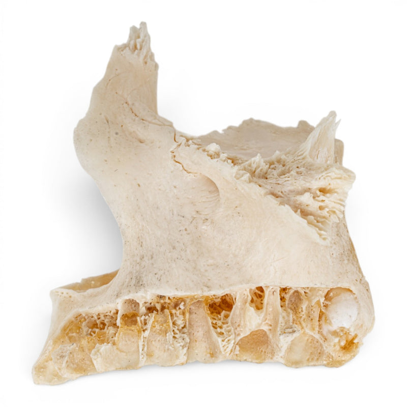 Real Human Maxillary Bone