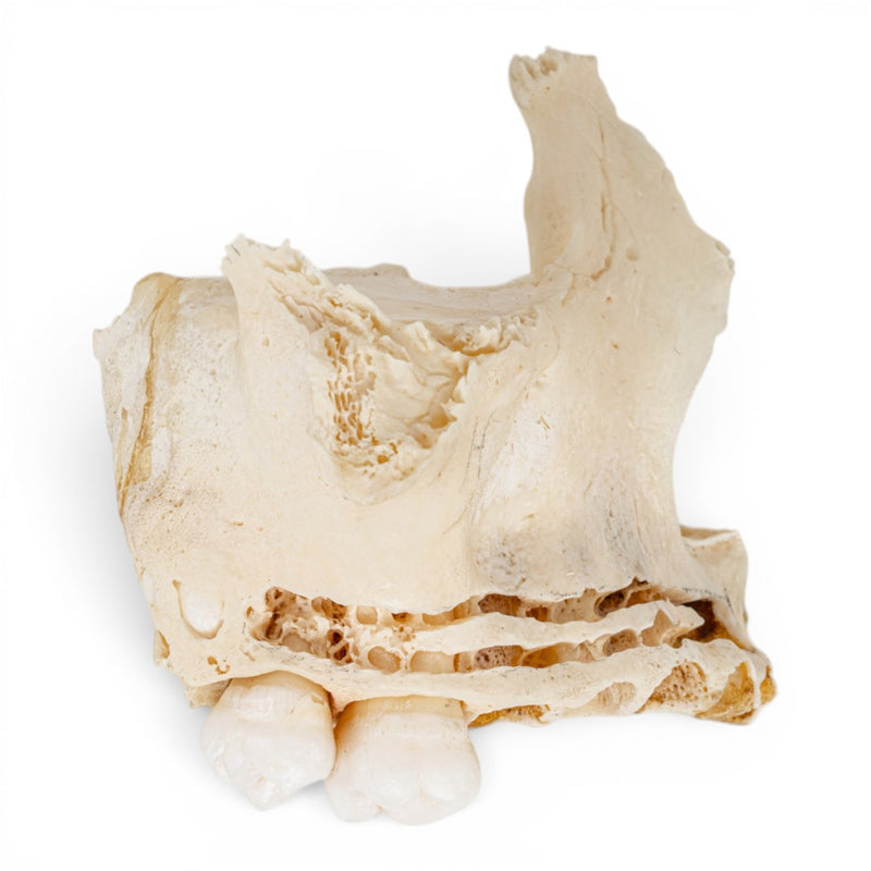 Real Human Maxillary Bone