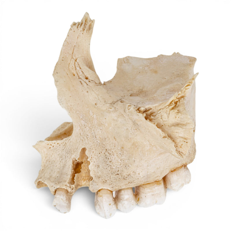 Real Human Maxillary Bone