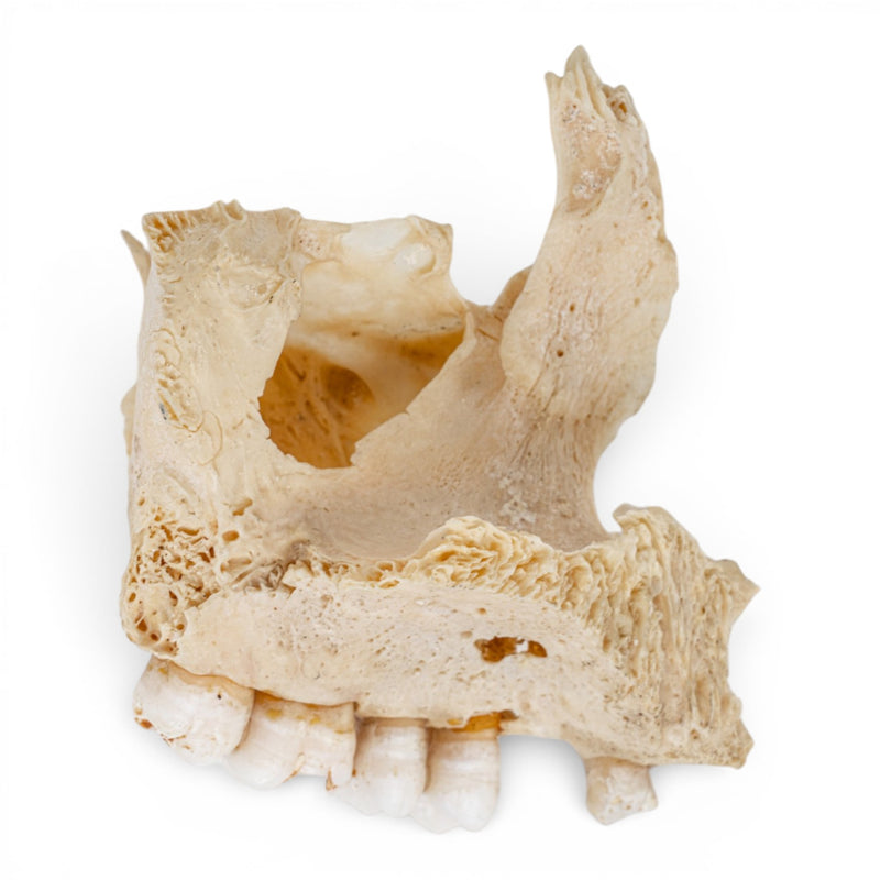 Real Human Maxillary Bone