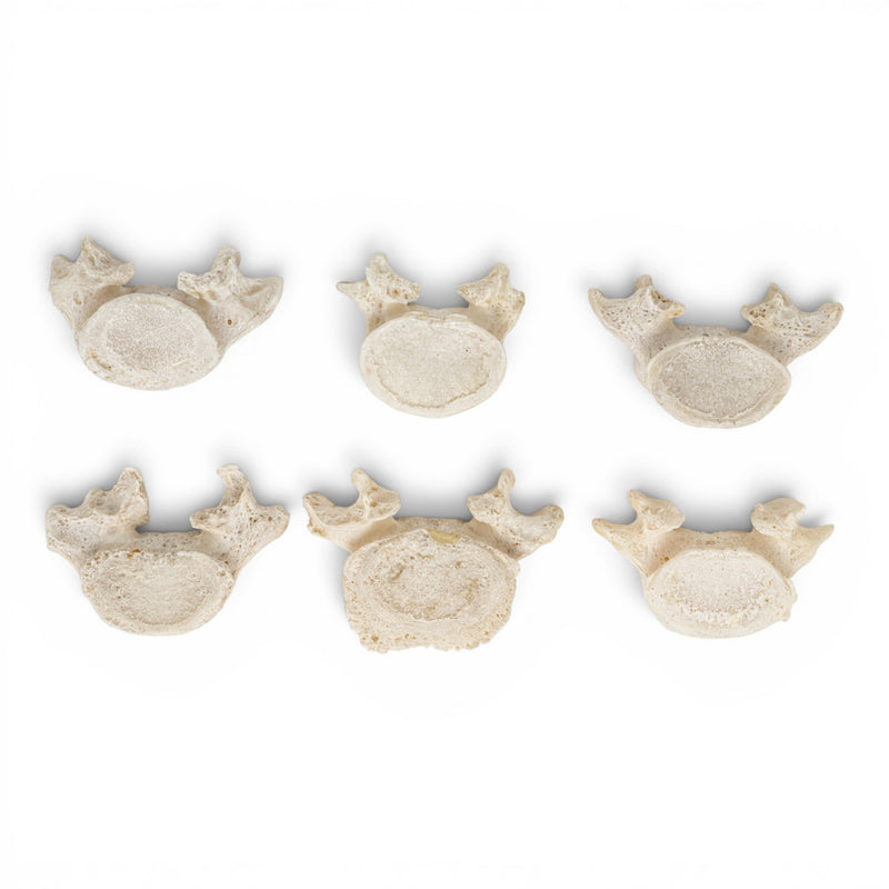 Real Human Lumbar Vertebrae