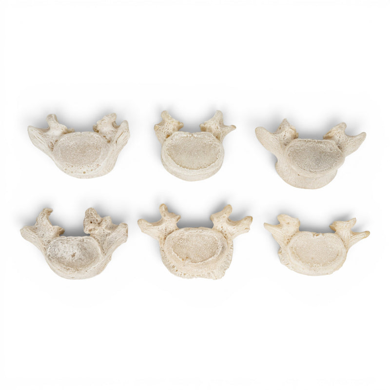 Real Human Lumbar Vertebrae