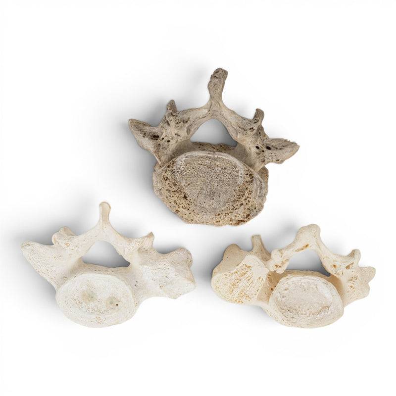 Real Human Lumbar Vertebrae
