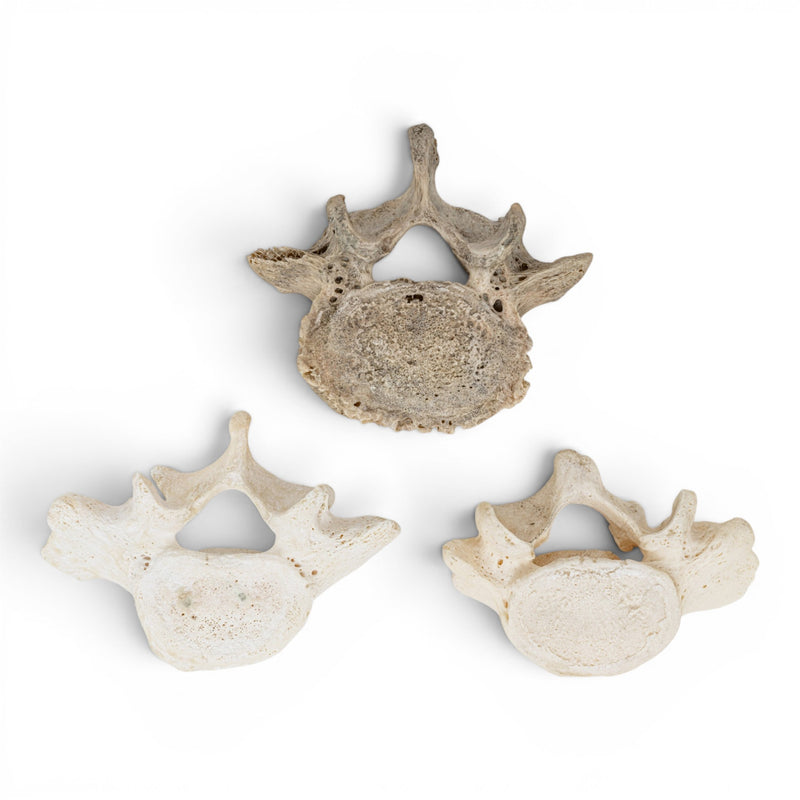 Real Human Lumbar Vertebrae