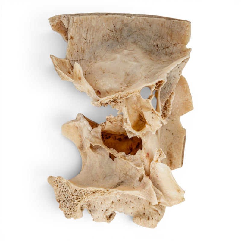 Real Human Partial Skull - Orbital