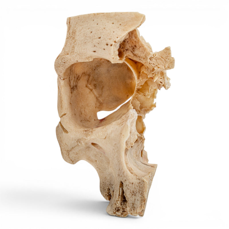 Real Human Partial Skull - Orbital