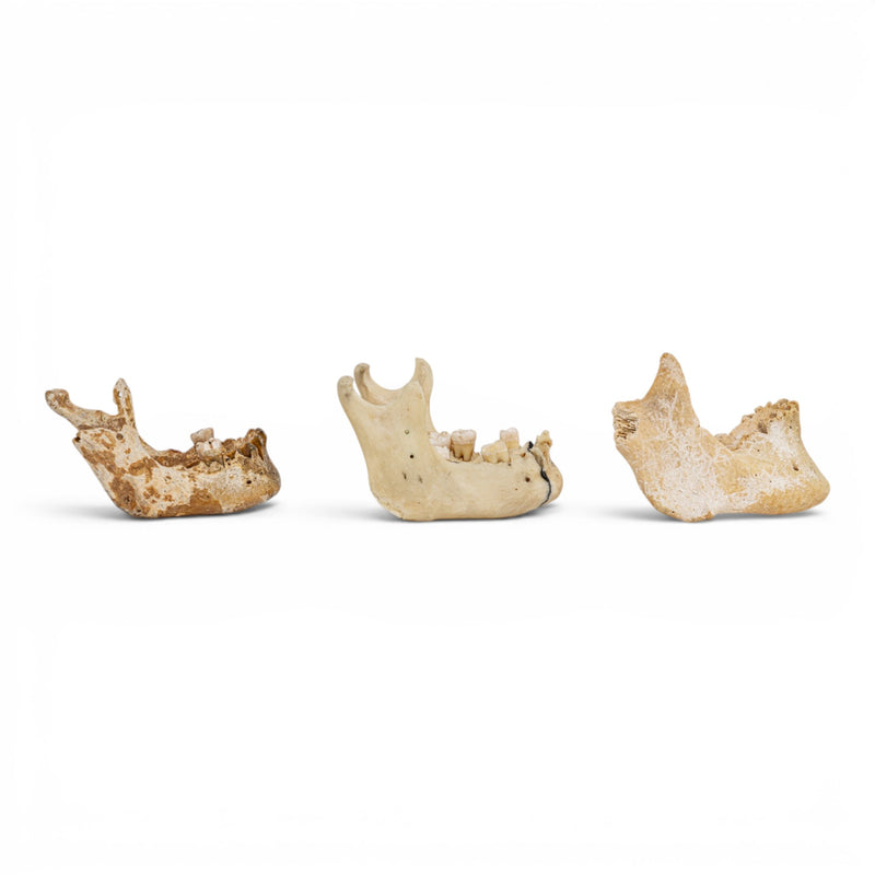 Real Human Mandible - Set of 3