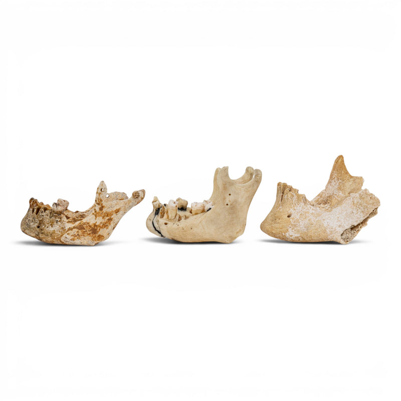 Real Human Mandible - Set of 3