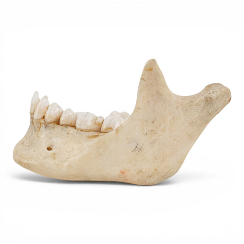 Real Human Mandible - Dissected