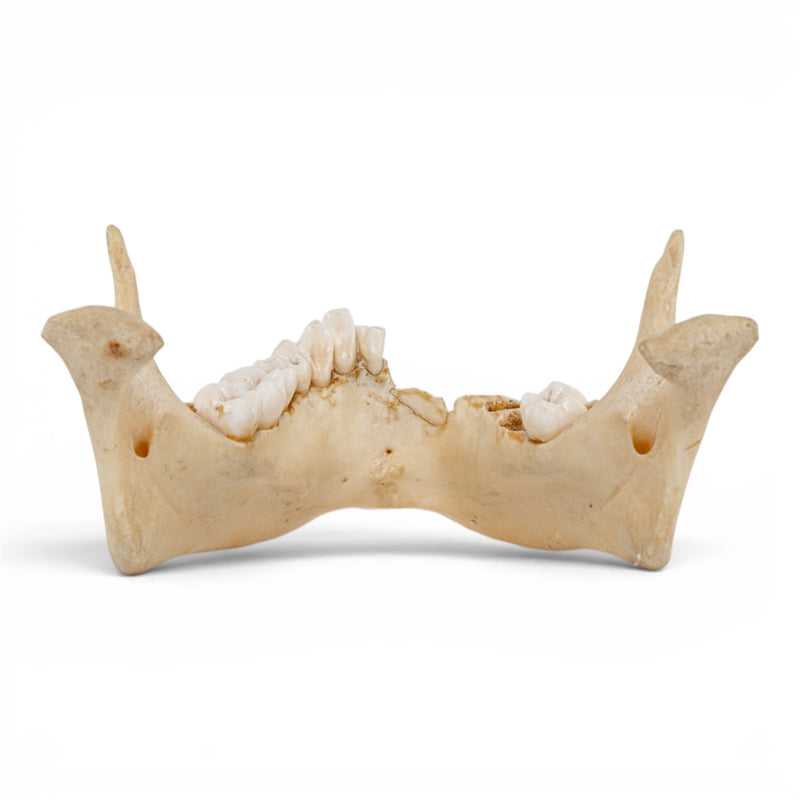 Real Human Mandible - Dissected