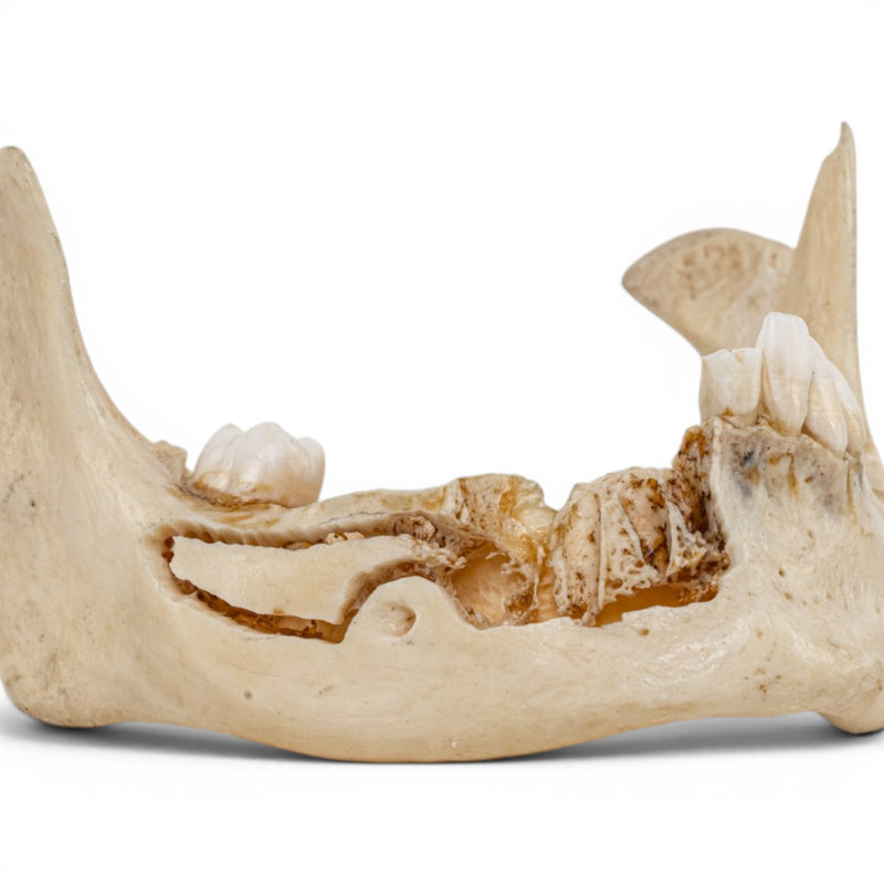 Real Human Mandible - Dissected