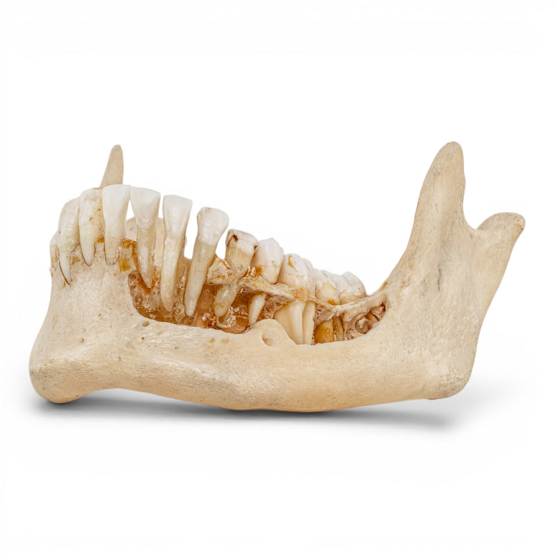 Real Human Mandible - Dissected