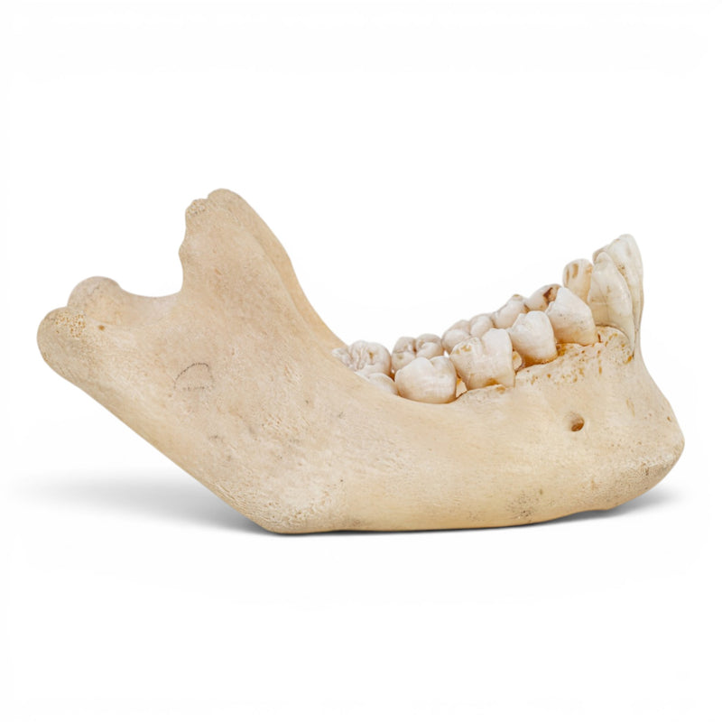 Real Human Mandible - Dissected