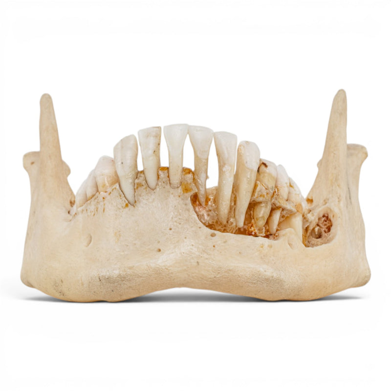 Real Human Mandible - Dissected