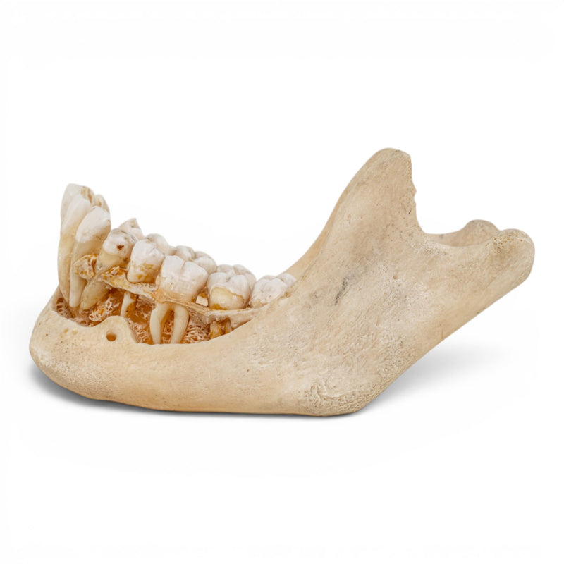 Real Human Mandible - Dissected
