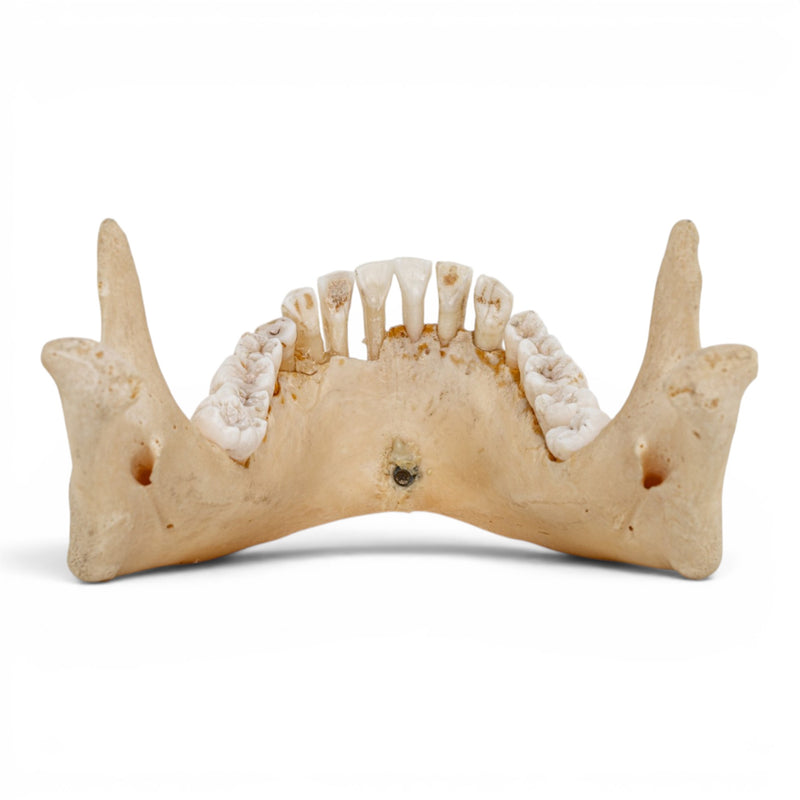 Real Human Mandible - Dissected