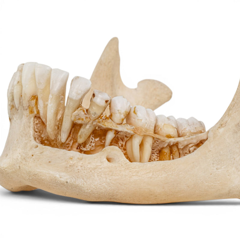 Real Human Mandible - Dissected