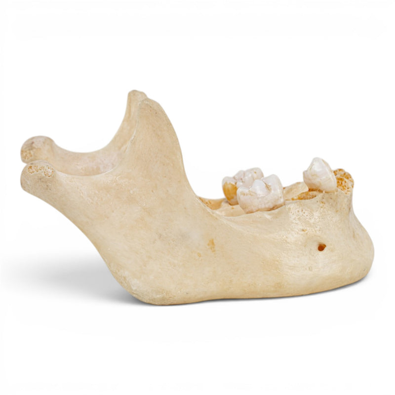 Real Human Mandible - Dissected