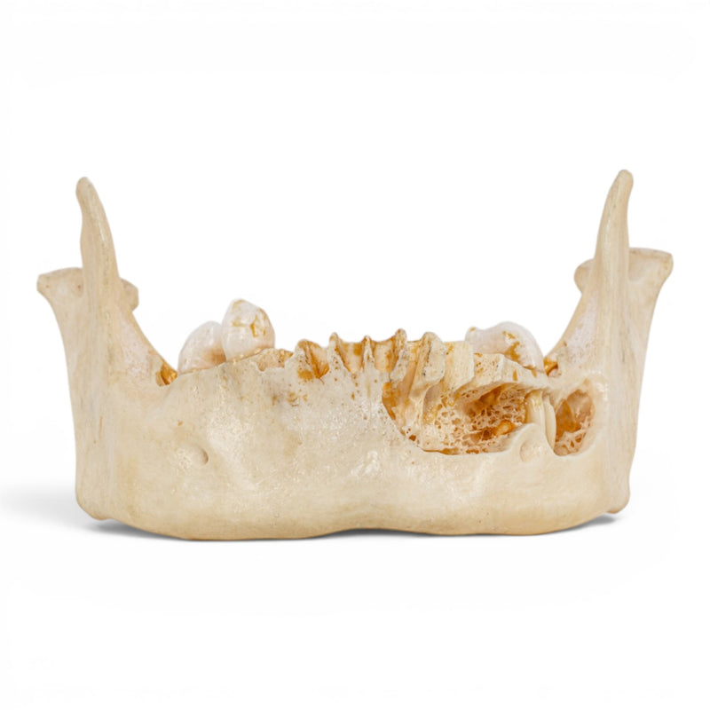 Real Human Mandible - Dissected