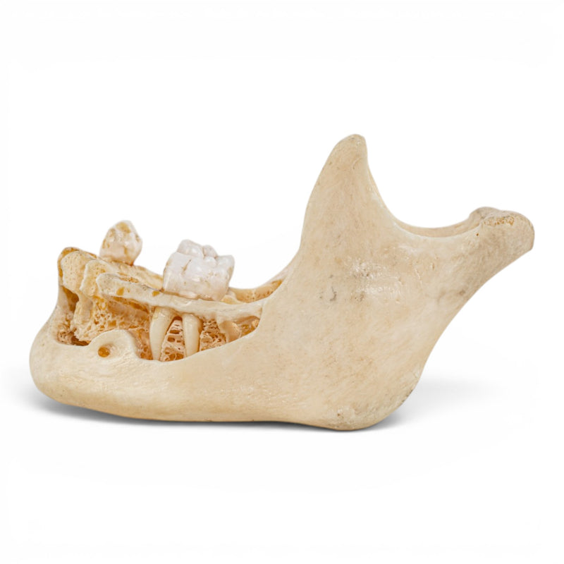 Real Human Mandible - Dissected