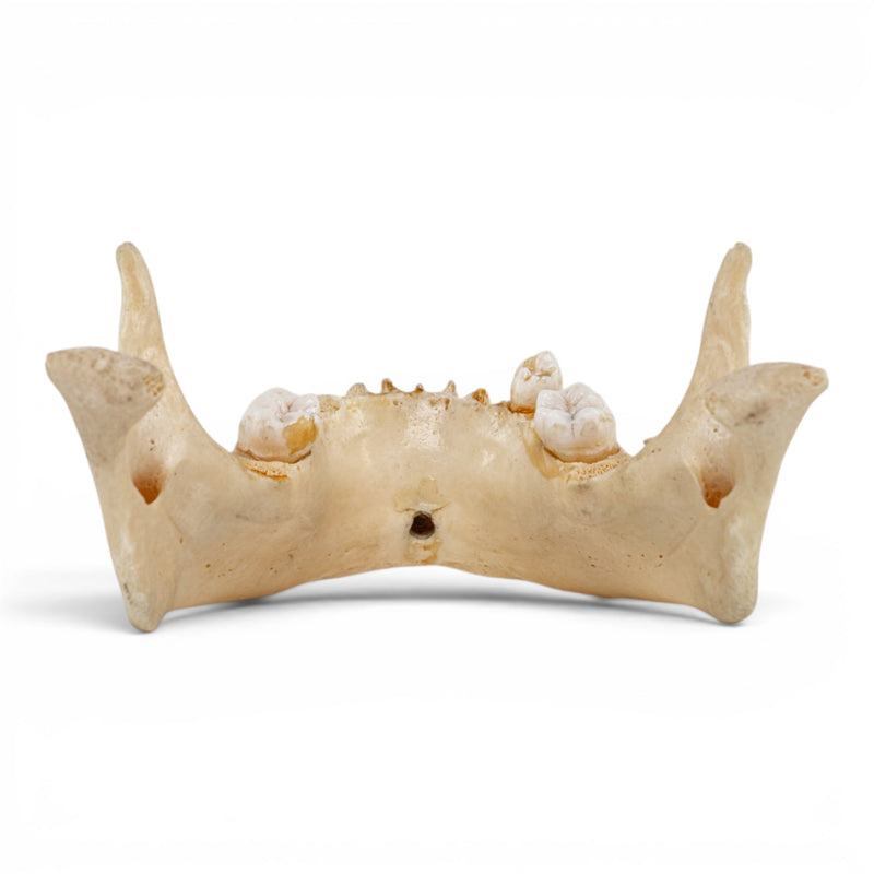 Real Human Mandible - Dissected
