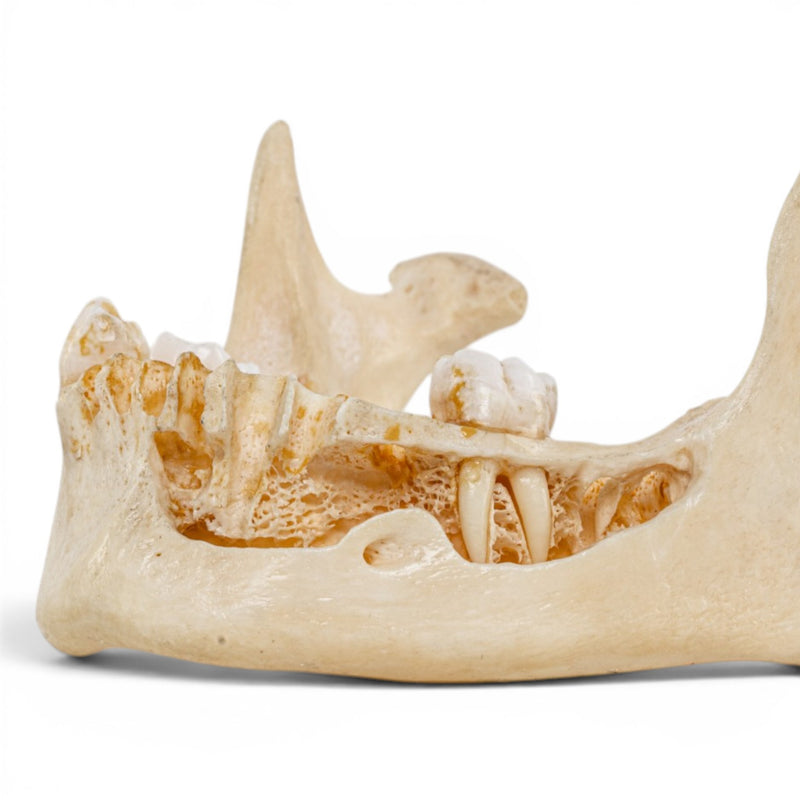 Real Human Mandible - Dissected