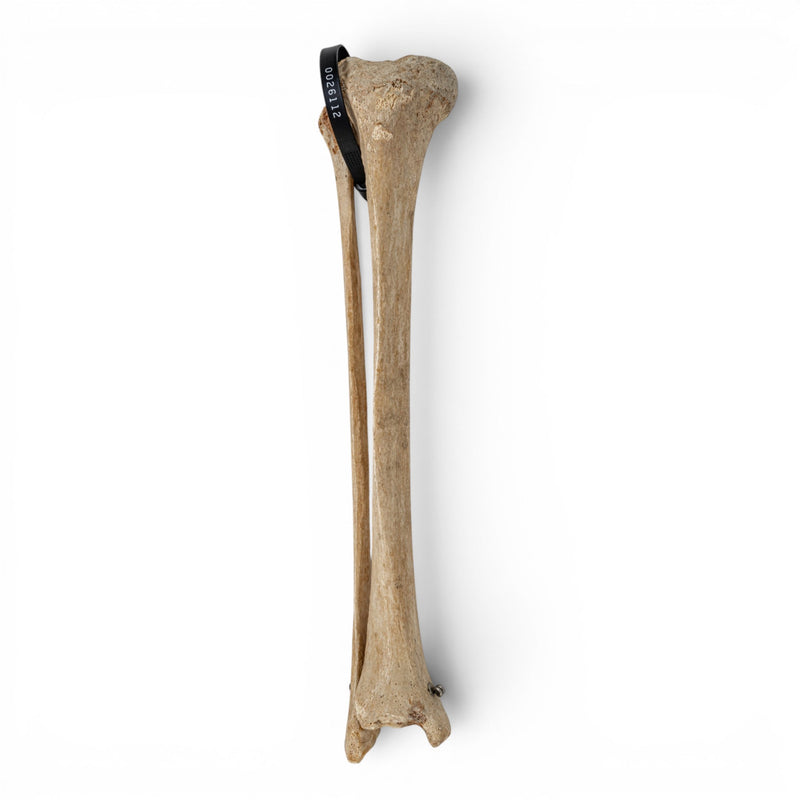 Real Human Tibia and Fibula - Articulated