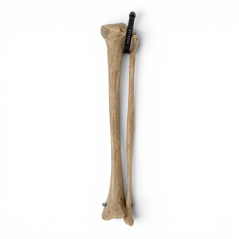 Real Human Tibia and Fibula - Articulated
