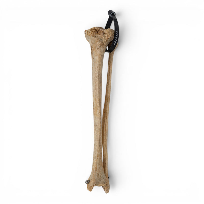 Real Human Tibia and Fibula