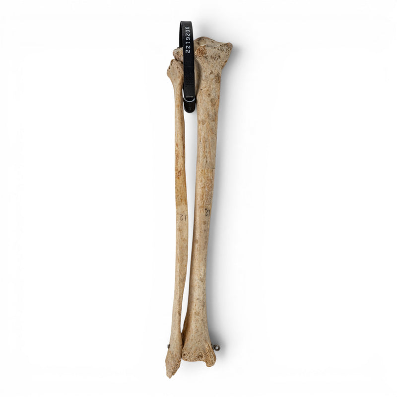 Real Human Tibia and Fibula