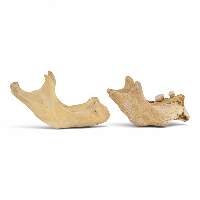 Real Human Mandible - Pathology - Set of 2