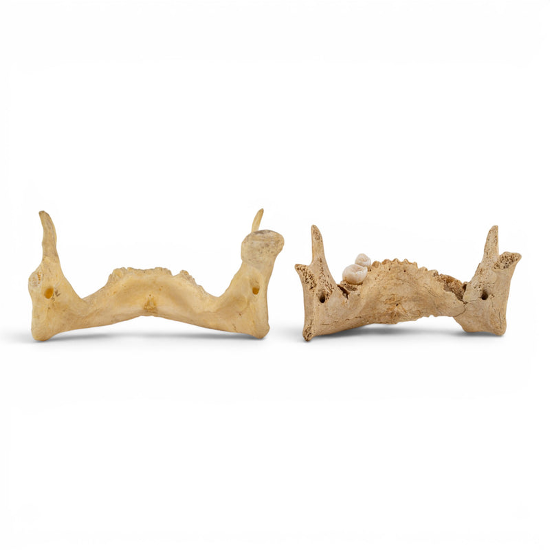 Real Human Mandible - Pathology - Set of 2