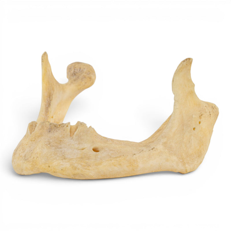 Real Human Mandible - Pathology - Set of 2