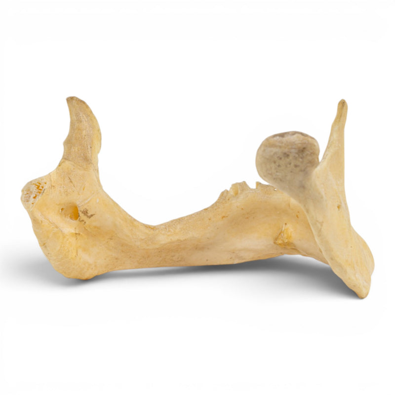 Real Human Mandible - Pathology - Set of 2
