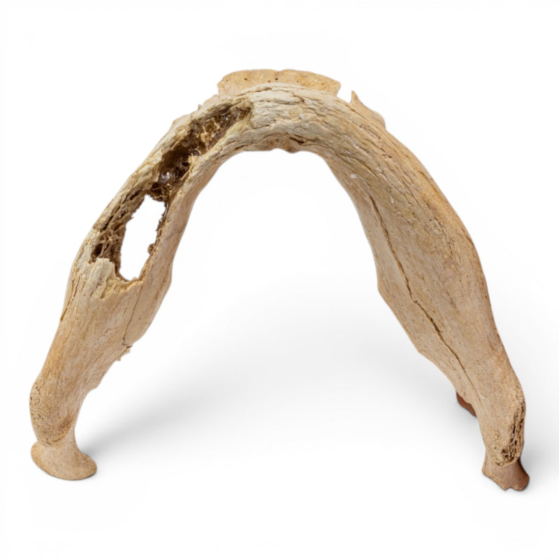 Real Human Mandible - Pathology - Set of 2