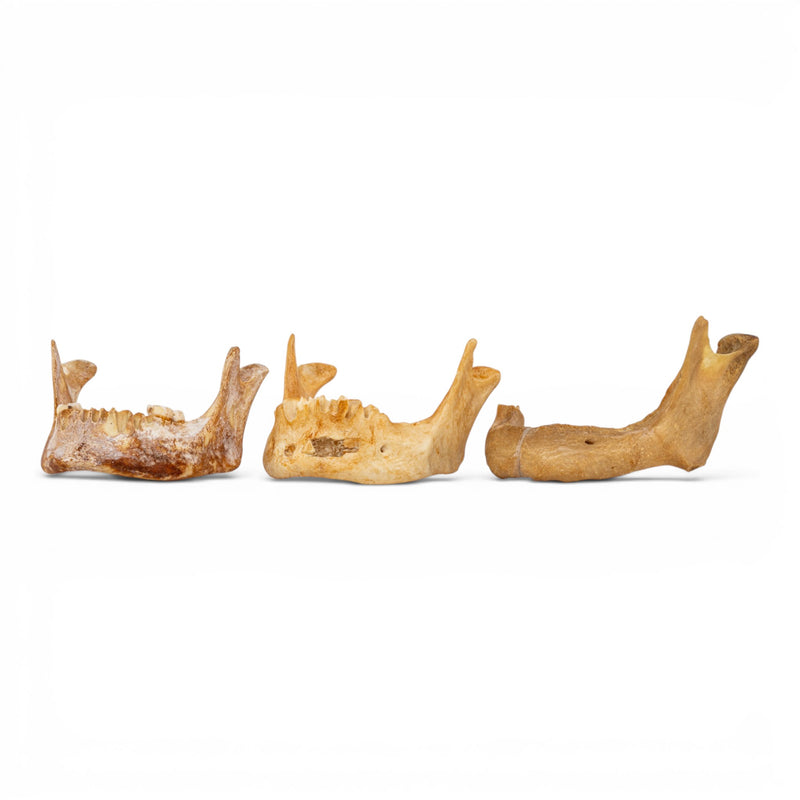 Real Human Mandible - Pathology - Set of 3