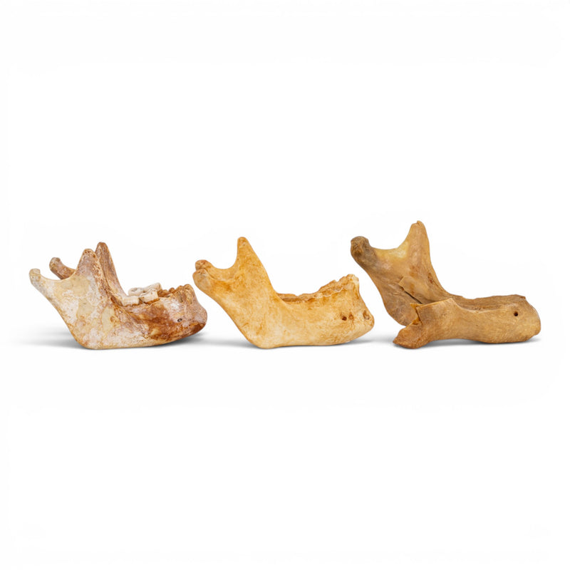 Real Human Mandible - Pathology - Set of 3