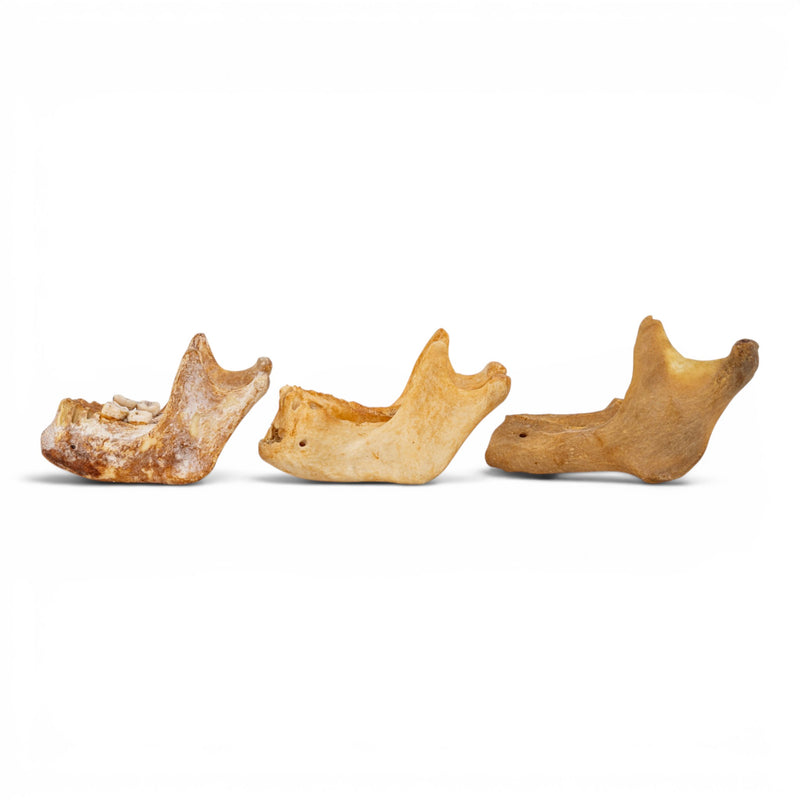 Real Human Mandible - Pathology - Set of 3