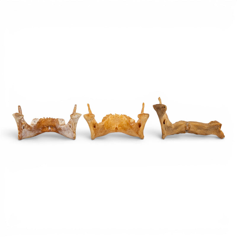 Real Human Mandible - Pathology - Set of 3