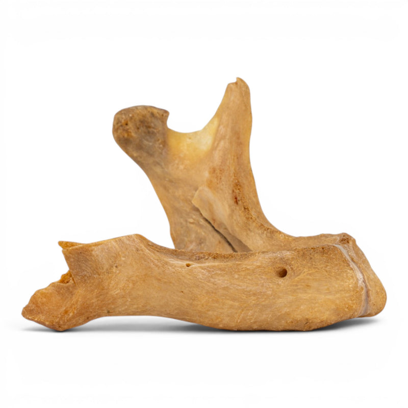 Real Human Mandible - Pathology - Set of 3