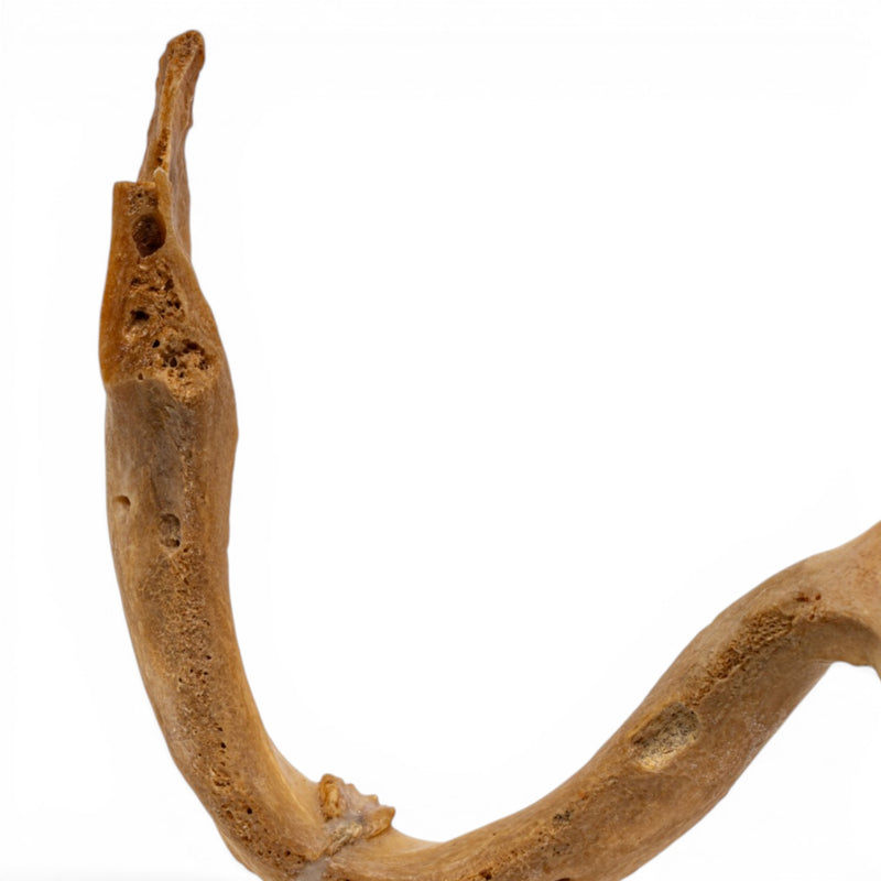 Real Human Mandible - Pathology - Set of 3